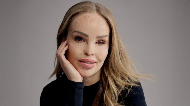 DK RED signs Katie Piper with book to 'challenge tired stereotypes and celebrate ageing'